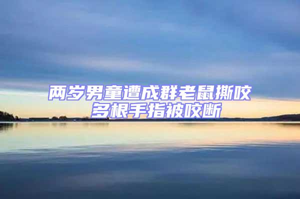 兩歲男童遭成群老鼠撕咬 多根手指被咬斷