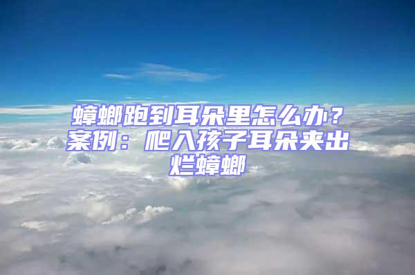 蟑螂跑到耳朵里怎么辦？案例：爬入孩子耳朵夾出爛蟑螂